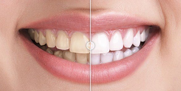 Before & After Images Comparison WordPress Plugin 1.0.1 Before & After Images Comparison WordPress Plugin 1.0.1